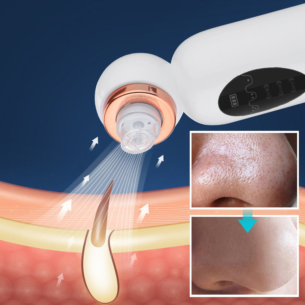 Hydrodermabrasie Blackhead Verwijderaar - Diepe Reiniging